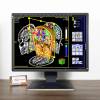 Màn hình 21 inch Eizo RadiForce RX350